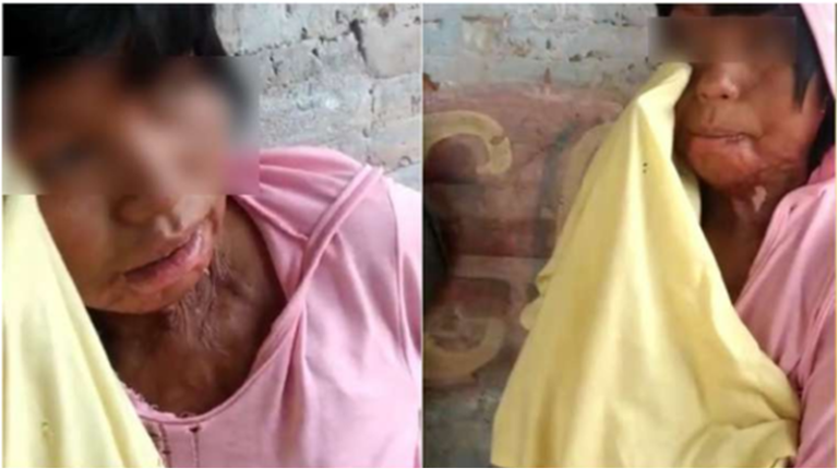 ´NAFTEAN´: ALERTA por los cinco jóvenes wichís que “MURIERON por el consumo de drogas, alcohol y NAFTA” en el NORTE