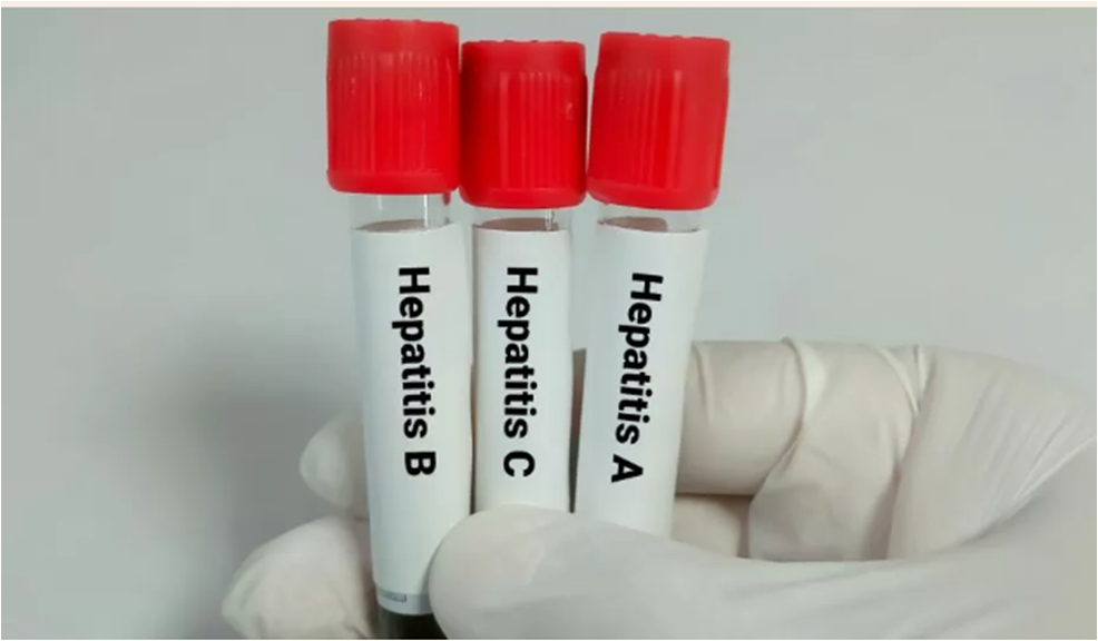 Los 4 síntomas de la hepatitis aguda infantil que preocupan a los expertos