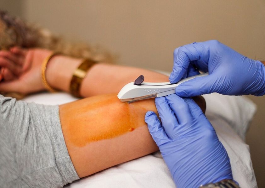 Se colocaron implantes subdérmicos anticonceptivos en Pichanal y Aguaray