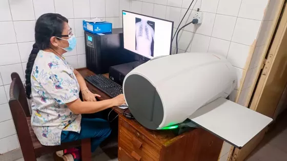Digitalizaron el equipo de Rayos X en el hospital de Apolinario Saravia