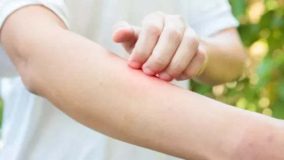 El hospital Materno Infantil realizará una campaña para la detección de dermatitis atópica